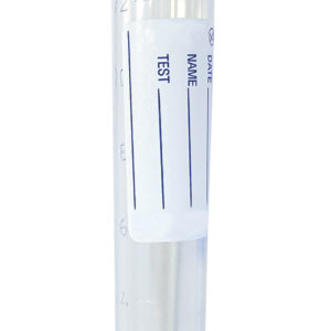provetta urine